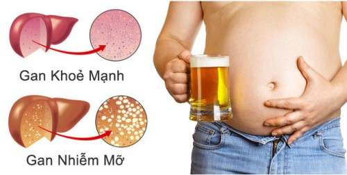 Rượu bia có hại như nào với cơ thể và lá gan con người? Cách giải độc bia rượu hiệu quả