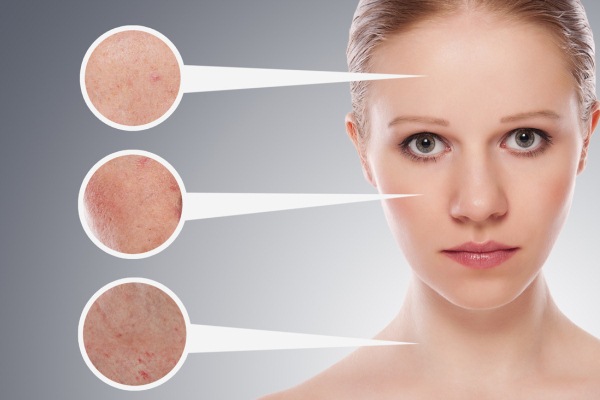 7 nguyên nhân phổ biến gây các bệnh về da bạn nên biết