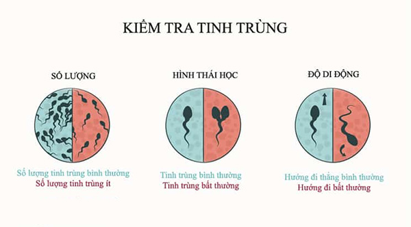 Chất lượng tinh trùng người Việt ngày càng giảm, tinh trùng loãng và bất thường?