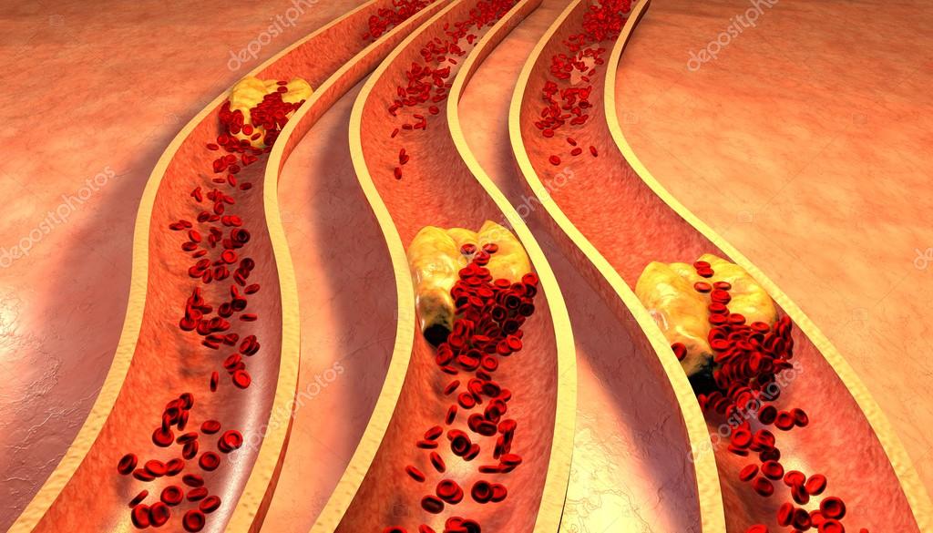 6  hành vi khiến mạch máu tắc nhanh hơn - rút ngắn tuổi thọ con người