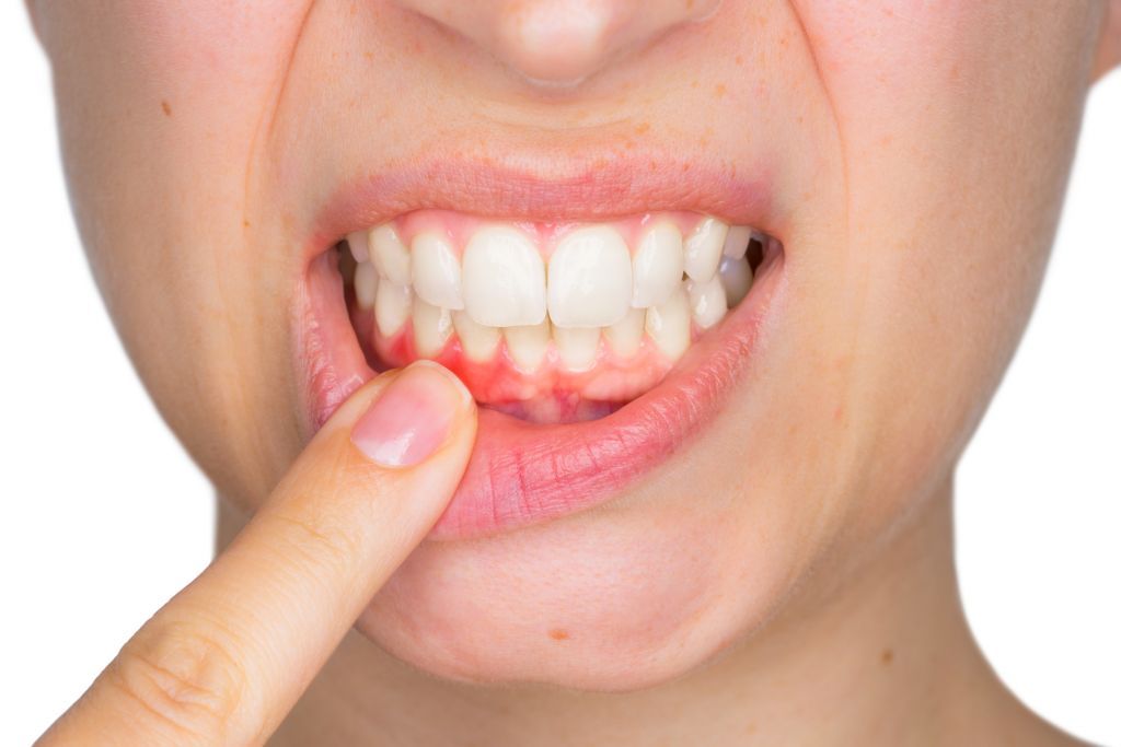 7 Dấu Hiệu Răng Miệng Tiết Lộ Sức Khỏe Tổng Thể Của Bạn Nên Biết