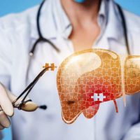 Xơ Gan Gây Giảm Tiểu Cầu Và Những Điều Bạn Chưa Biết